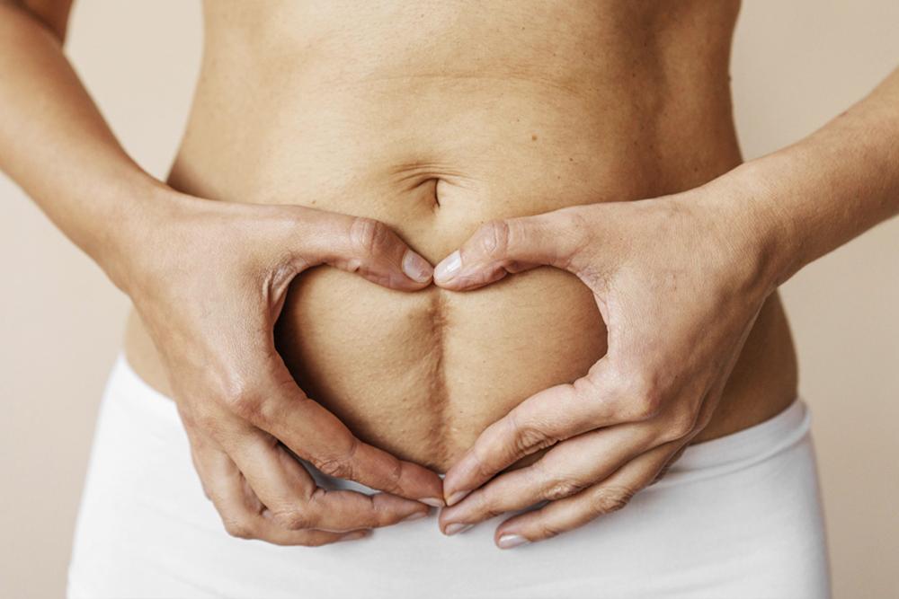 Diastasi addominale: come riconoscerla e quale pancera usare per un supporto efficace?